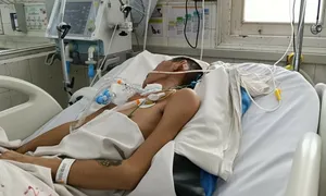 Cảnh giác viêm não, viêm màng não cuối năm